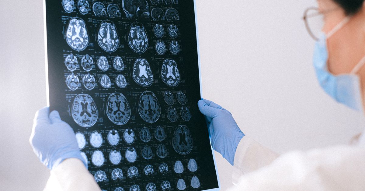How Your Brain's "Fat Storage" Genes May Influence Alzheimer's Risk
